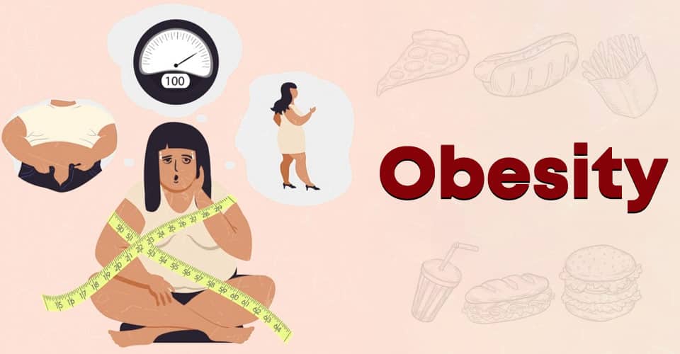 Obesity