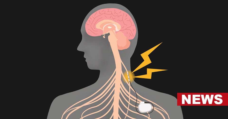 Vagus Nerve Stimulation Helps You Deal With Tense Situations 3 Vagus Nerve Stimulation Helps You Deal With Tense Situations
