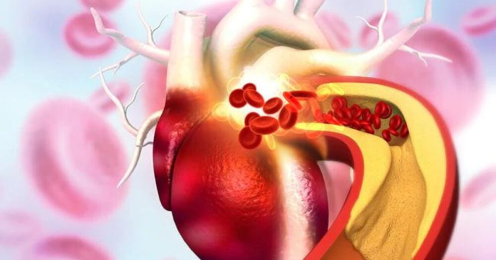 Unveiling The Link: How Stress Impacts Cholesterol Levels And Heart Health 9 Unveiling The Link: How Stress Impacts Cholesterol Levels And Heart Health