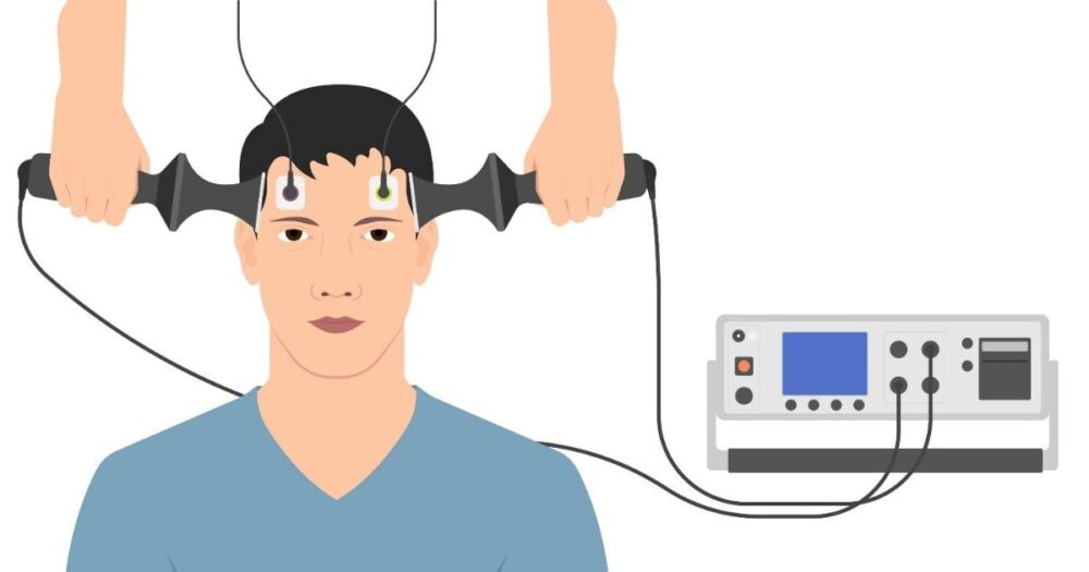 Groundbreaking Research Reveals the Intricacies of Electroconvulsive Therapy (ECT) in Treating Depression 25 Groundbreaking Research Reveals the Intricacies of Electroconvulsive Therapy (ECT) in Treating Depression